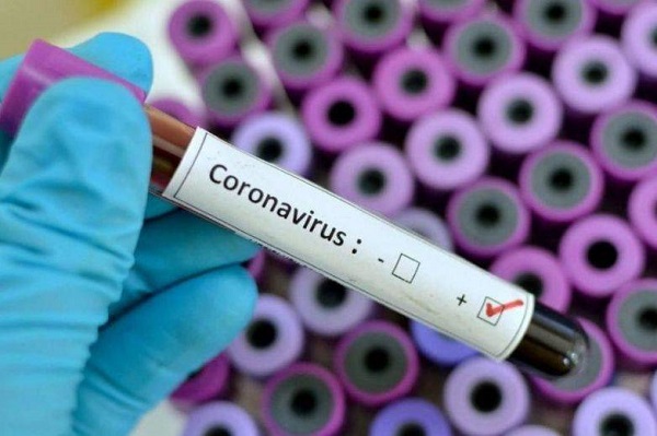 Coronavirus: hubo 35 muertes en 24 horas y la Argentina superó los 100 mil casos