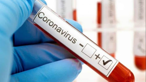 Coronavirus: Misiones, única provincia de Argentina sin casos activos confirmados de Covid-19