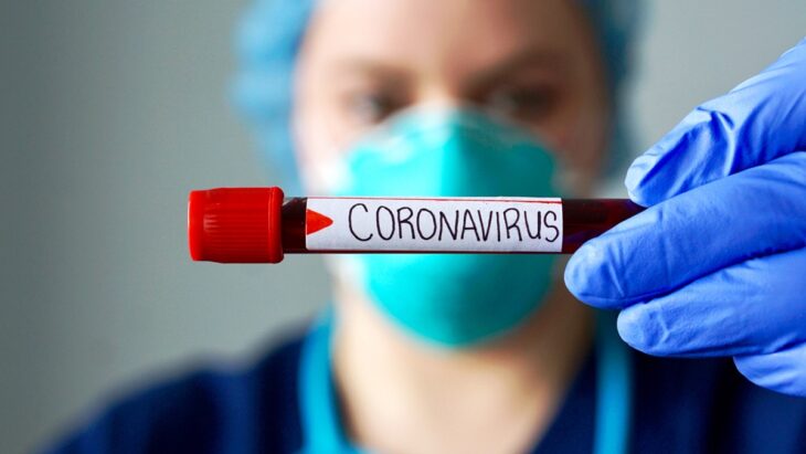 positivo para coronavirus