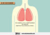 Día Mundial de la Enfermedad Pulmonar Obstructiva Crónica