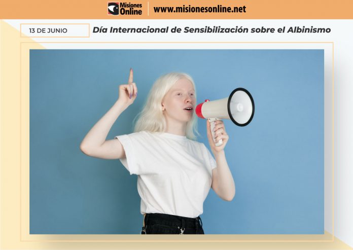 albinismo