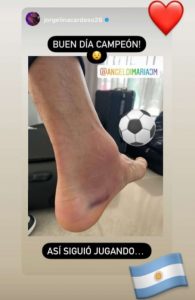 Así le quedó el tobillo a Di María después de la final: el detalle de la foto que publicó en las redes
