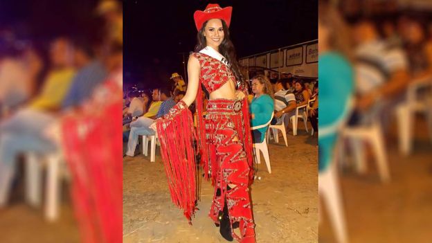 reina de la belleza murió durante una cirugía