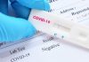 autotest rápidos para el coronavirus