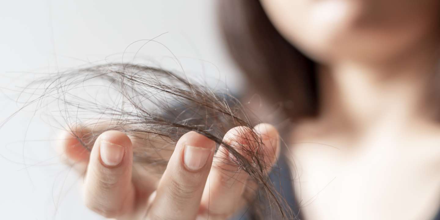 Qué es la alopecia areata, la enfermedad autoinmune que afecta a Jada Pinkett Smith