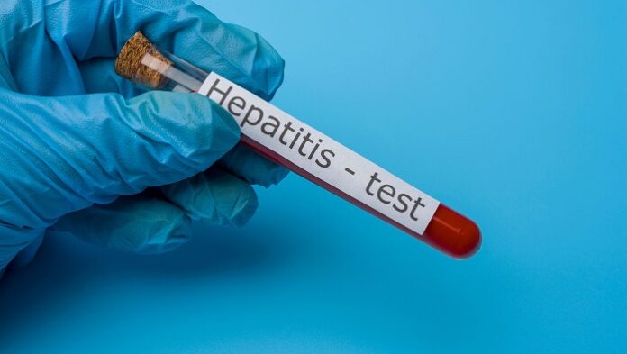 casos de hepatitis
