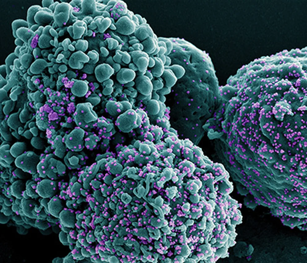 ¿Comenzó una nueva ola de contagios de COVID en la Argentina? / National Institute of Allergy and Infectious Diseases