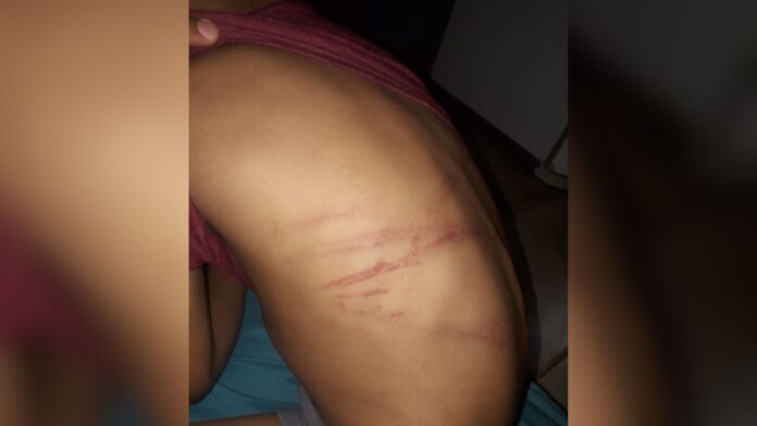 hijo de 7 años es brutalmente golpeado