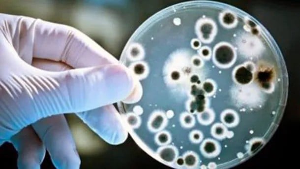 Streptococcus pyogenes bacteria que causó muertes