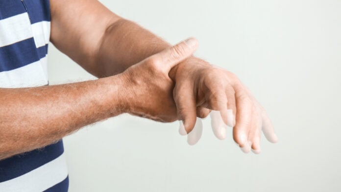 enfermedad de Parkinson