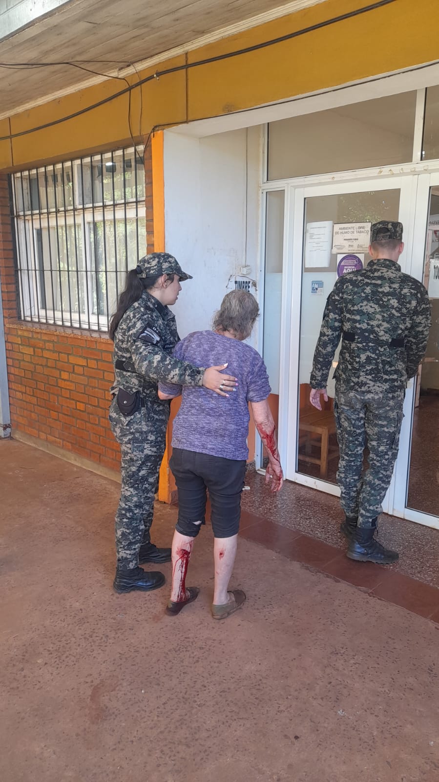 atacada por los perros de su vecina 
