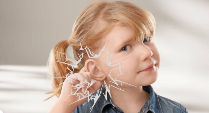 niños con pérdida auditiva niños con pérdida auditiva