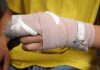 Detuvieron a un hombre tras cortarle los dedos a su novia